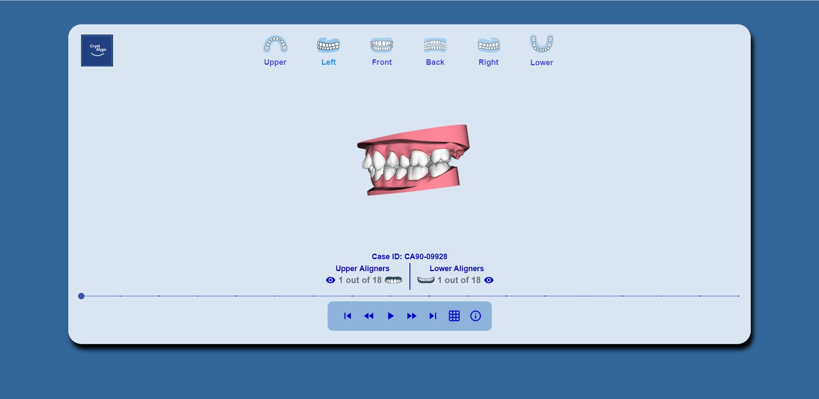 Left buccal view. Every view is the same model, not a rendered image.
